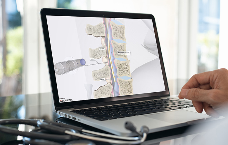 Doctor looking at 3D Model of spine on tablet